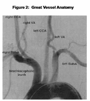 Great Vessel Anatomy