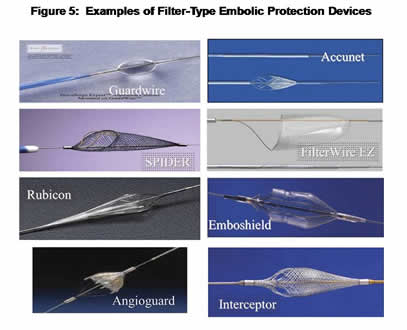 Examples of Filter-Type Embolic Protection Devices